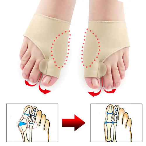 Orthèse Hallux valgus Soulage Pieds