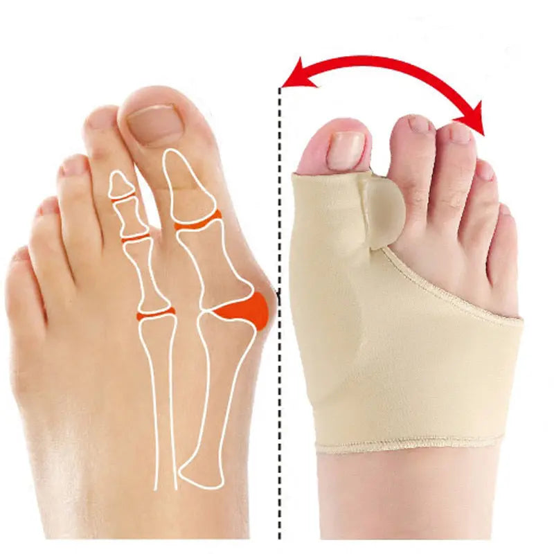 Orthèse Hallux valgus Soulage Pieds